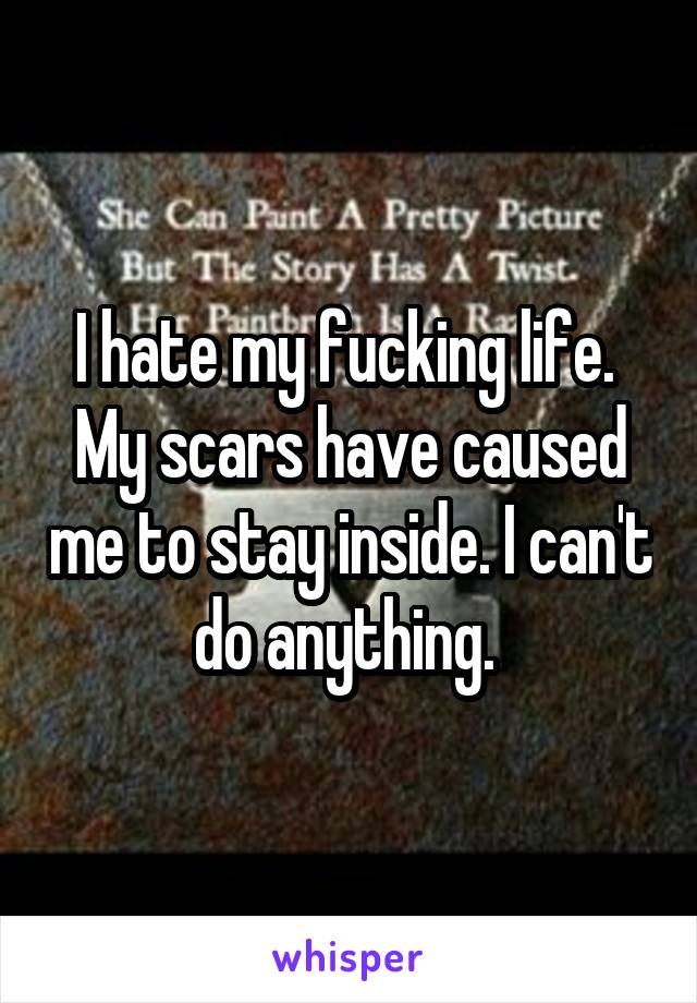 I hate my fucking life. 
My scars have caused me to stay inside. I can't do anything. 