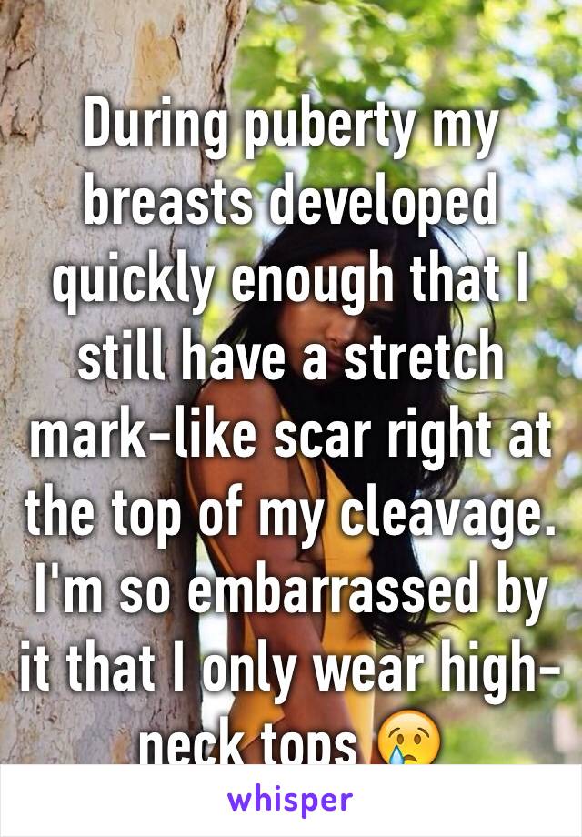 During puberty my breasts developed quickly enough that I still have a stretch mark-like scar right at the top of my cleavage. I'm so embarrassed by it that I only wear high-neck tops 😢