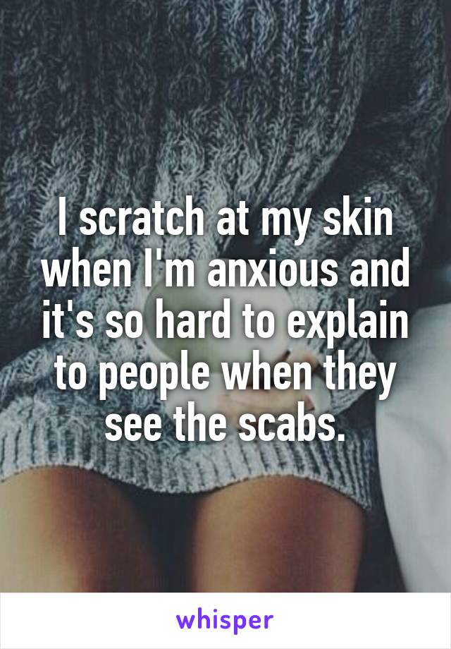 I scratch at my skin when I'm anxious and it's so hard to explain to people when they see the scabs.