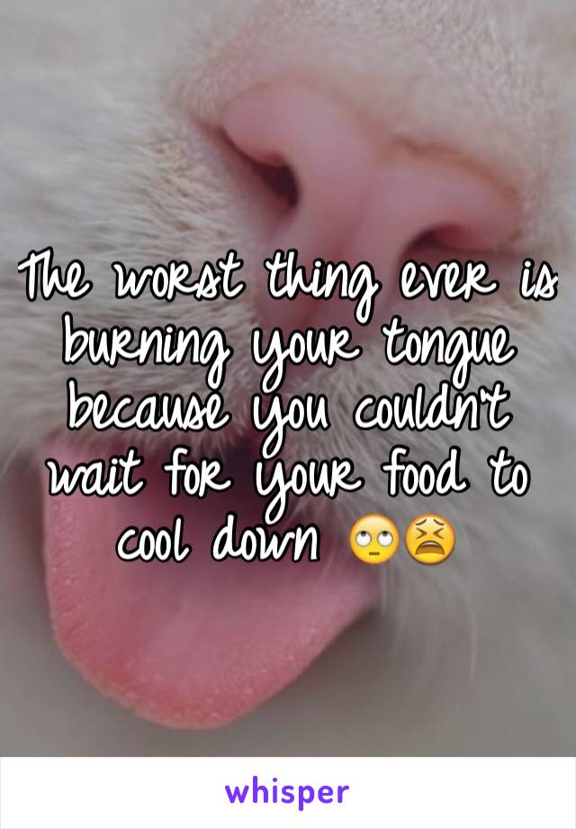 The worst thing ever is burning your tongue because you couldn't wait for your food to cool down 🙄😫