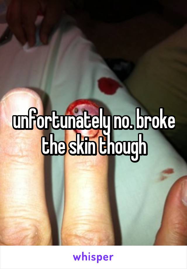 unfortunately no. broke the skin though