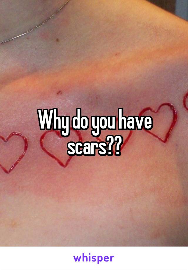 Why do you have scars??