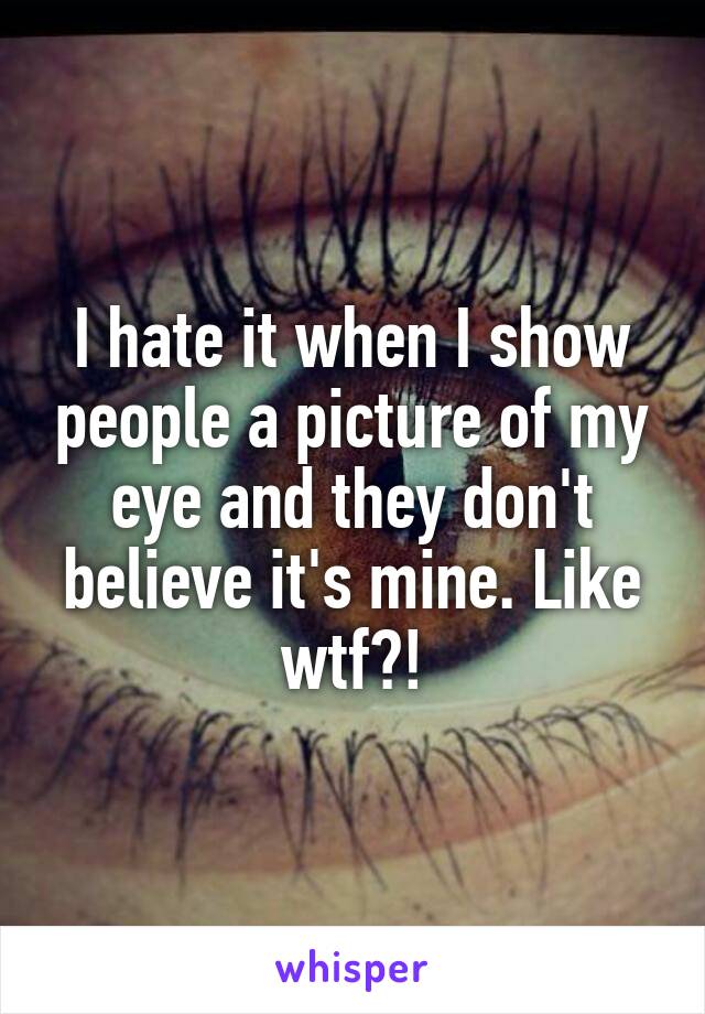 I hate it when I show people a picture of my eye and they don't believe it's mine. Like wtf?!