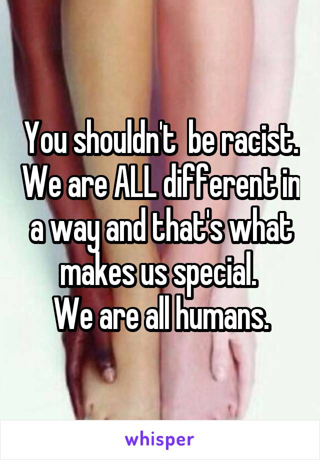 You shouldn't  be racist. We are ALL different in a way and that's what makes us special. 
We are all humans.