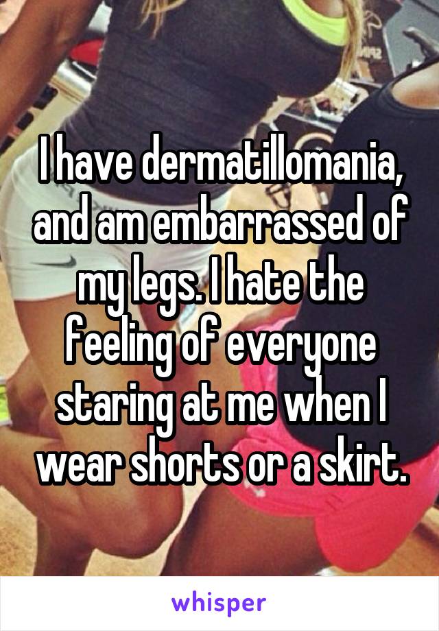 I have dermatillomania, and am embarrassed of my legs. I hate the feeling of everyone staring at me when I wear shorts or a skirt.