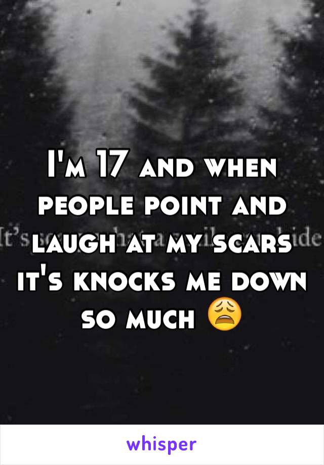 I'm 17 and when people point and laugh at my scars it's knocks me down so much 😩