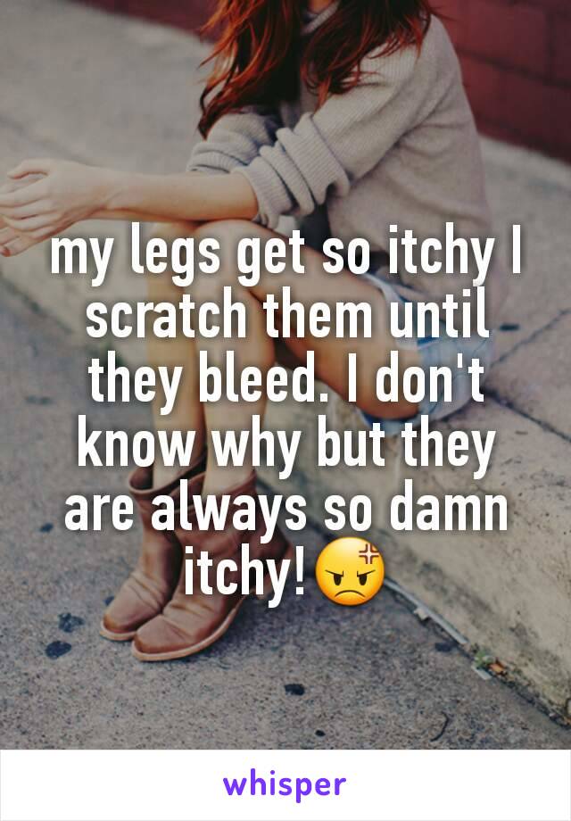 my legs get so itchy I scratch them until they bleed. I don't know why but they are always so damn itchy!😡