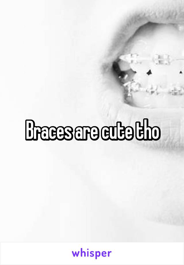 Braces are cute tho