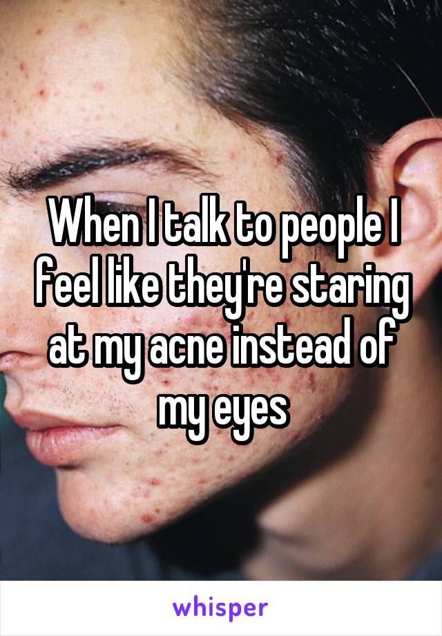 When I talk to people I feel like they're staring at my acne instead of my eyes