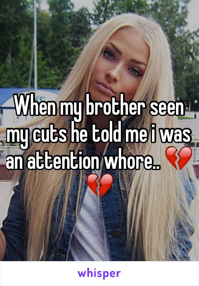 When my brother seen my cuts he told me i was an attention whore.. 💔💔