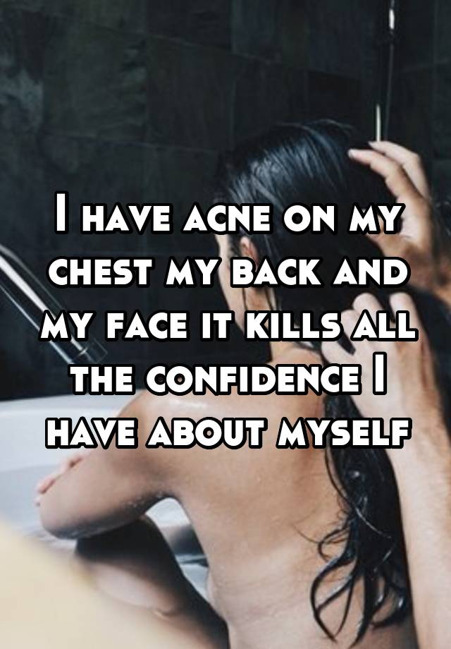 i-have-acne-on-my-chest-my-back-and-my-face-it-kills-all-the-confidence