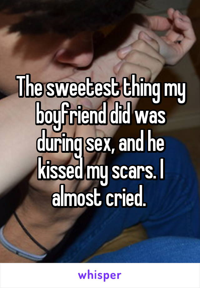The sweetest thing my boyfriend did was during sex, and he kissed my scars. I almost cried. 