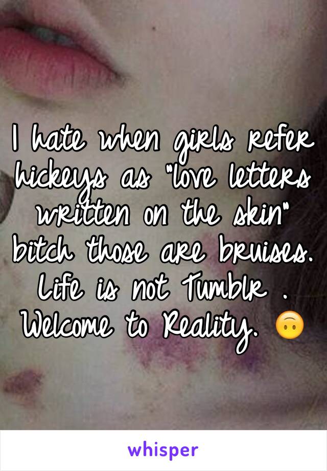 I hate when girls refer hickeys as "love letters written on the skin" bitch those are bruises. Life is not Tumblr .
Welcome to Reality. 🙃