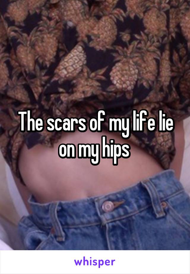 The scars of my life lie on my hips 