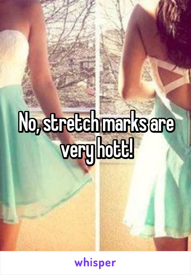 No, stretch marks are very hott!