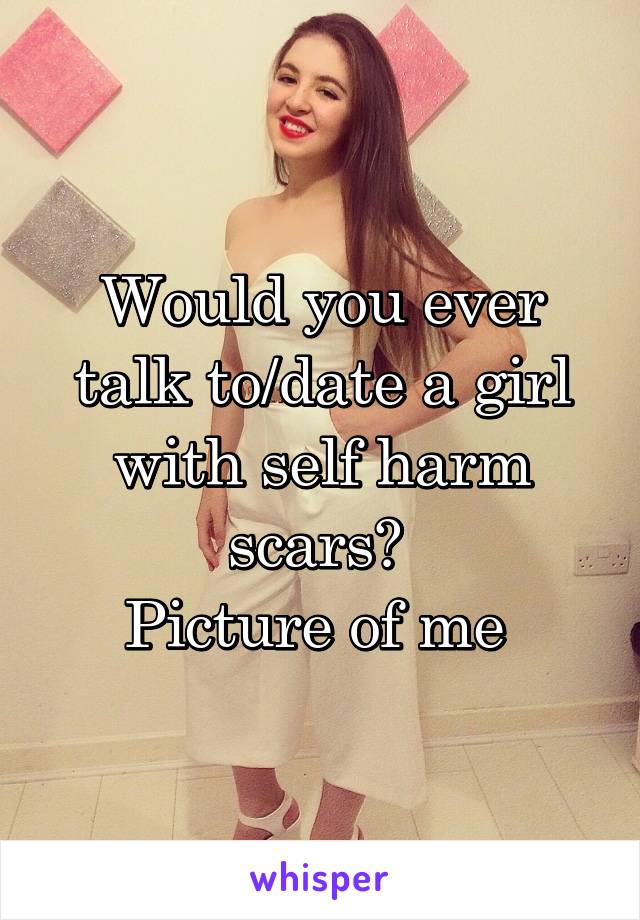 Would you ever talk to/date a girl with self harm scars? 
Picture of me 