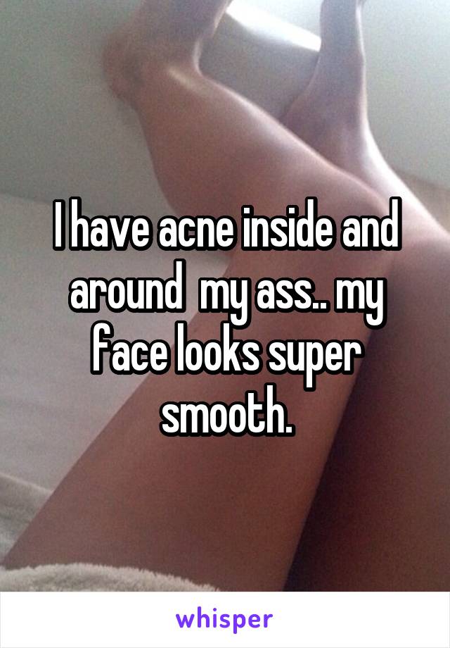 I have acne inside and around  my ass.. my face looks super smooth.