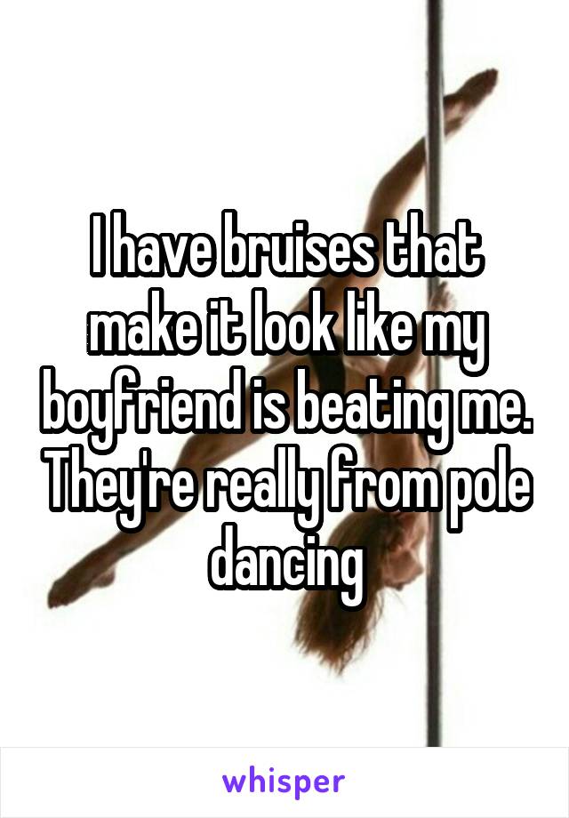 I have bruises that make it look like my boyfriend is beating me. They're really from pole dancing