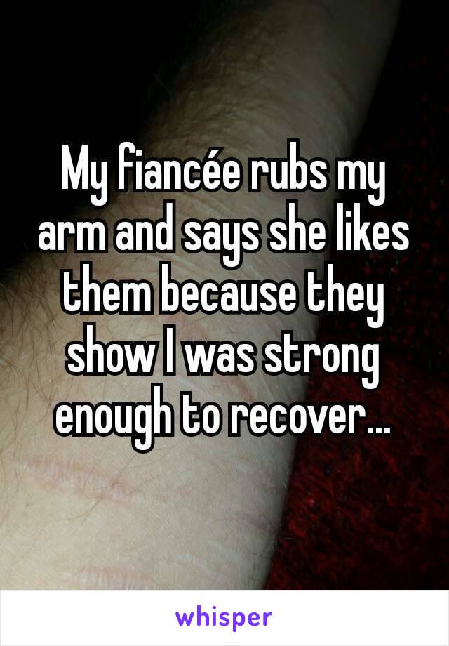 My fiancée rubs my arm and says she likes them because they show I was strong enough to recover...
