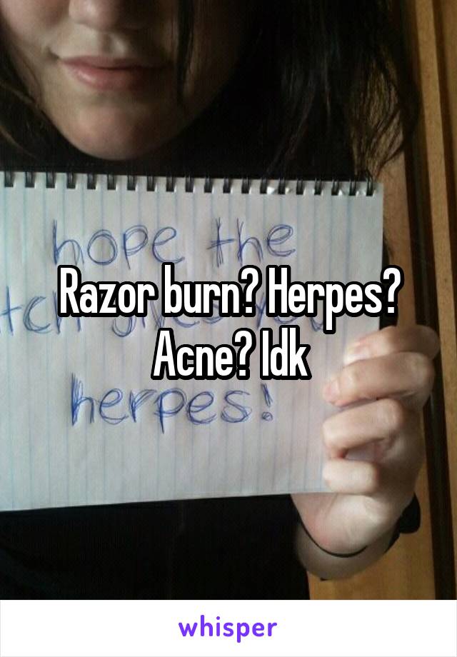 Razor burn? Herpes? Acne? Idk