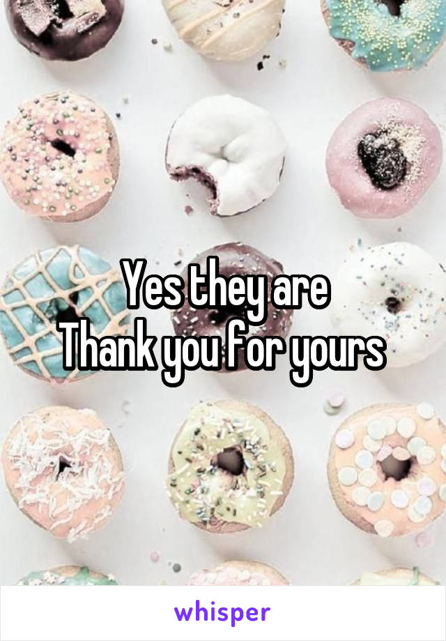 Yes they are
Thank you for yours 