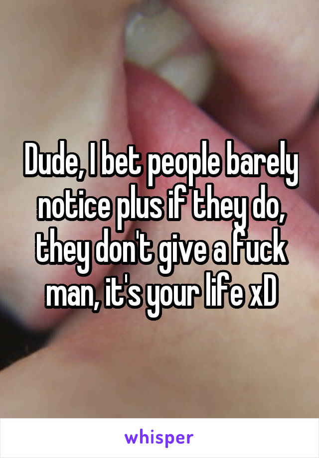 Dude, I bet people barely notice plus if they do, they don't give a fuck man, it's your life xD