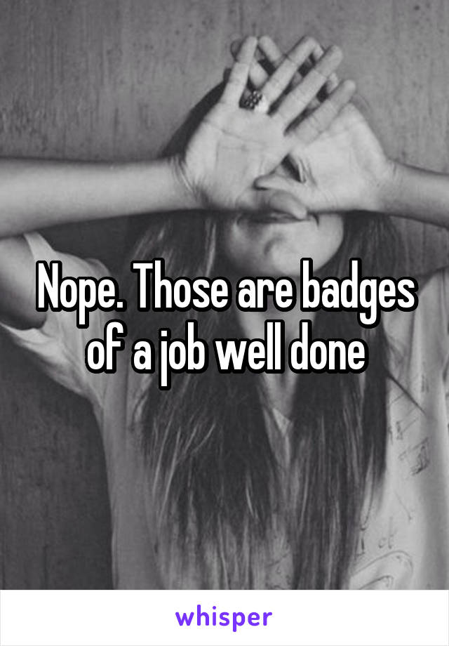 Nope. Those are badges of a job well done