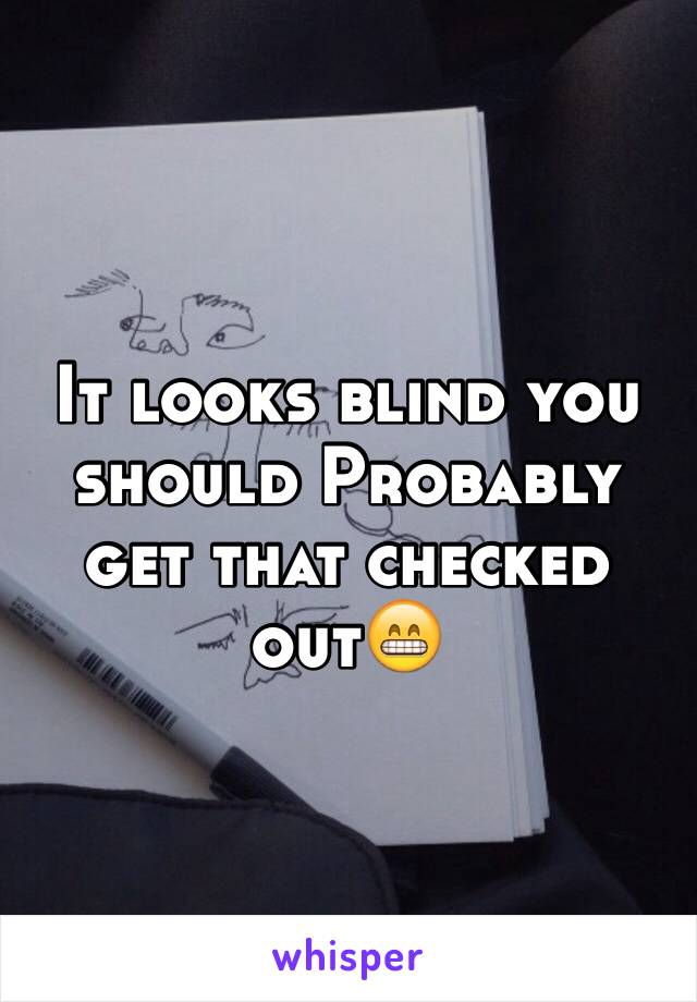 It looks blind you should Probably get that checked out😁