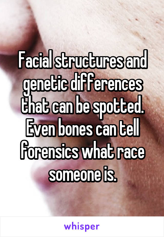 Facial structures and genetic differences that can be spotted. Even bones can tell forensics what race someone is.