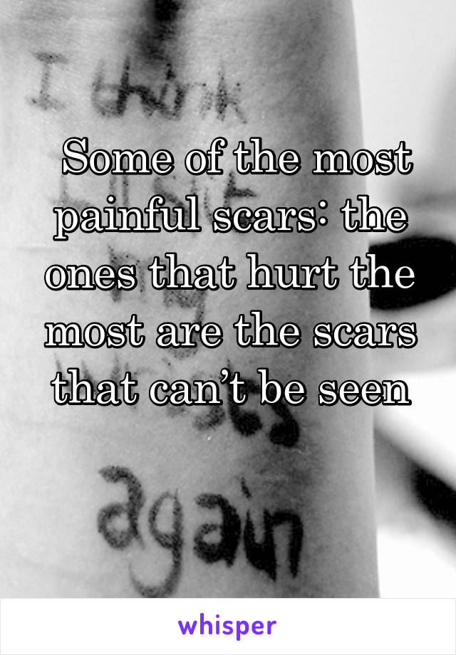  Some of the most painful scars: the ones that hurt the most are the scars that can’t be seen

