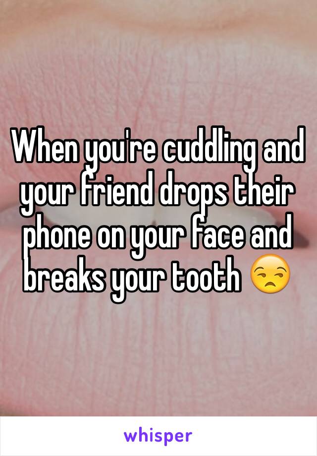 When you're cuddling and your friend drops their phone on your face and breaks your tooth 😒