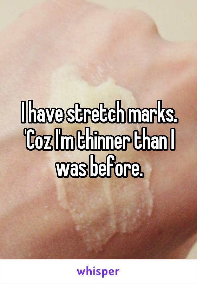 I have stretch marks.
'Coz I'm thinner than I was before.