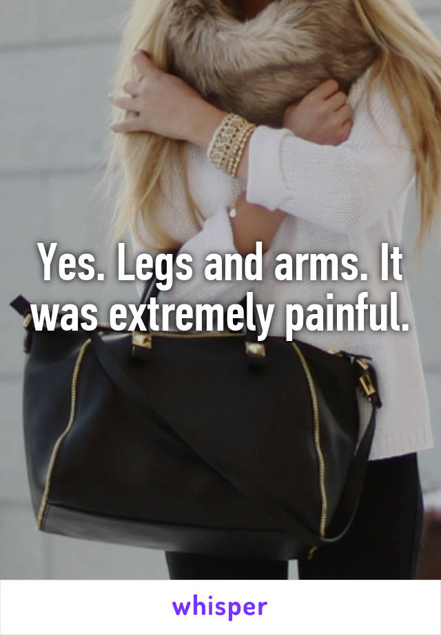 Yes. Legs and arms. It was extremely painful. 