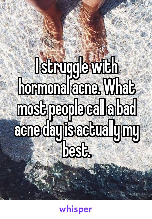 I struggle with hormonal acne. What most people call a bad acne day is actually my best.