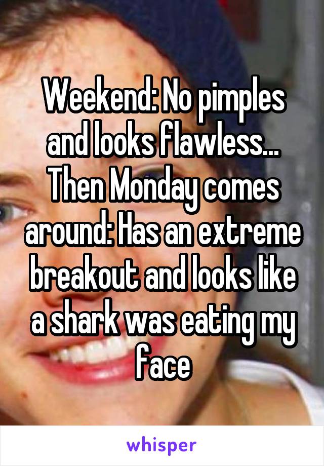 Weekend: No pimples and looks flawless... Then Monday comes around: Has an extreme breakout and looks like a shark was eating my face