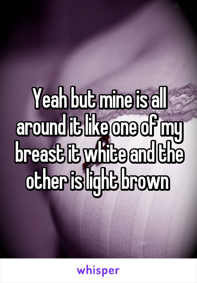 Yeah but mine is all around it like one of my breast it white and the other is light brown 