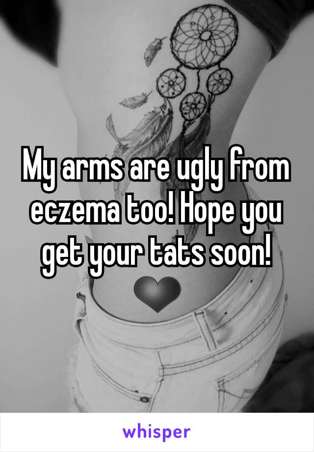 My arms are ugly from eczema too! Hope you get your tats soon! ❤