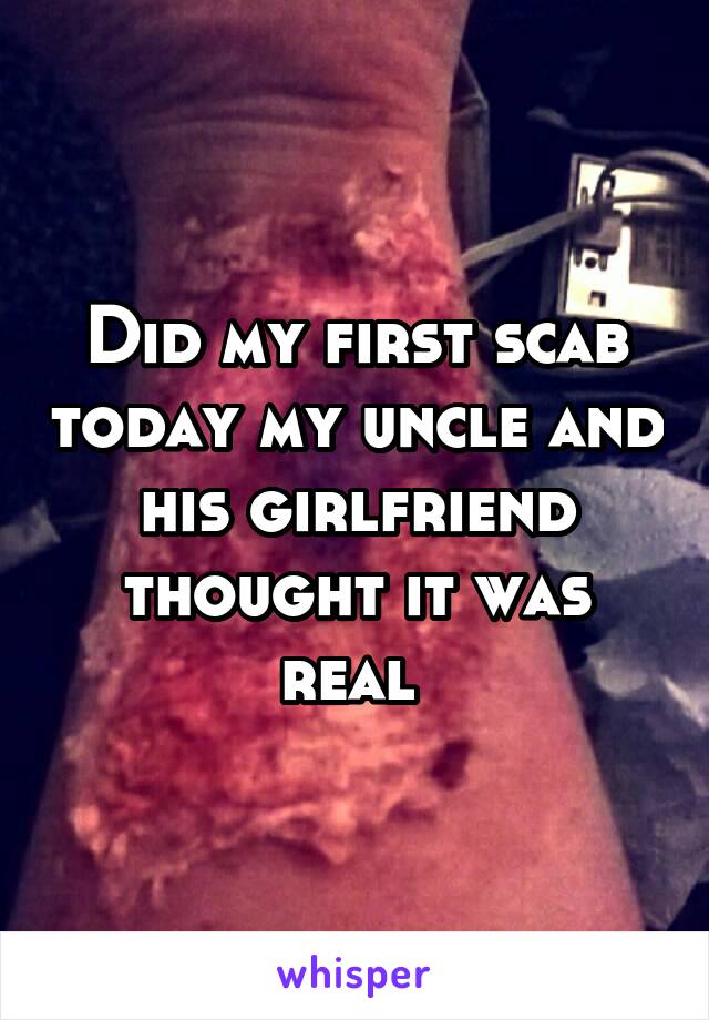 Did my first scab today my uncle and his girlfriend thought it was real 