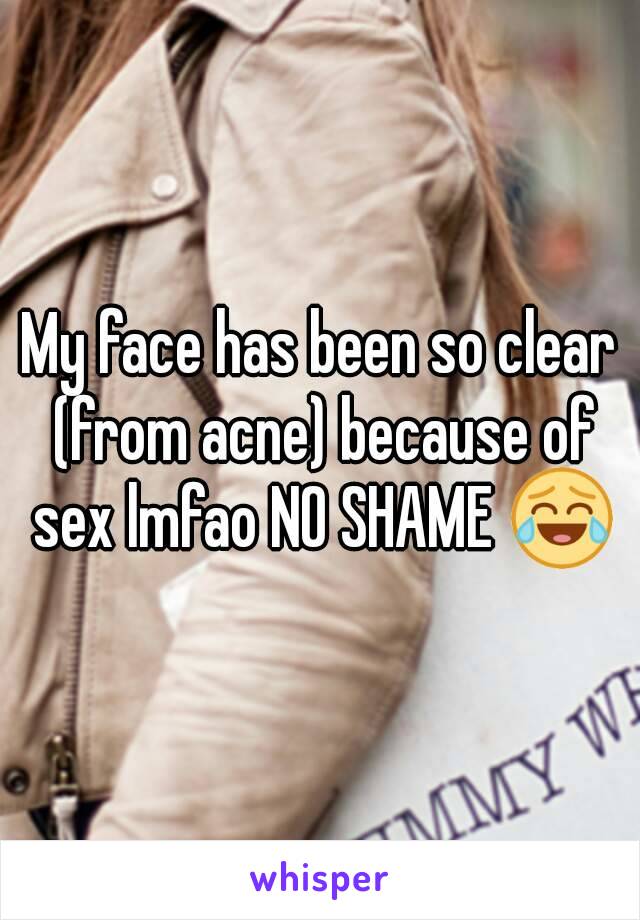 My face has been so clear (from acne) because of sex lmfao NO SHAME 😂