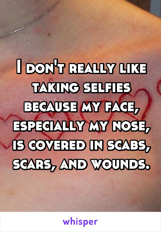 I don't really like taking selfies because my face, especially my nose, is covered in scabs, scars, and wounds.