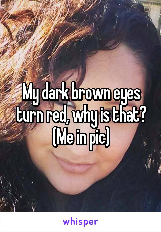 My dark brown eyes turn red, why is that?
(Me in pic)