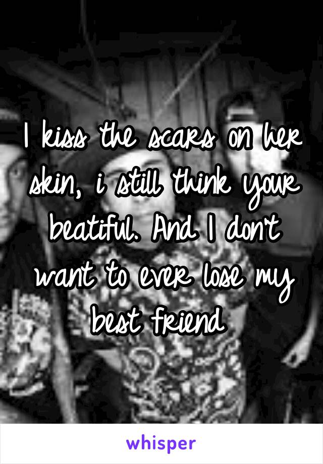 I kiss the scars on her skin, i still think your beatiful. And I don't want to ever lose my best friend 