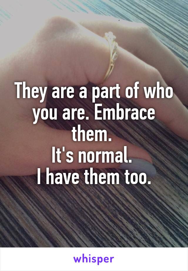 They are a part of who you are. Embrace them. 
It's normal. 
I have them too.