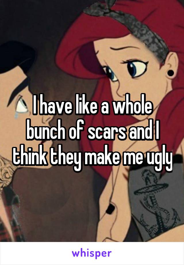 I have like a whole bunch of scars and I think they make me ugly