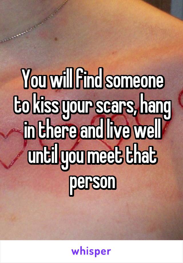 You will find someone to kiss your scars, hang in there and live well until you meet that person