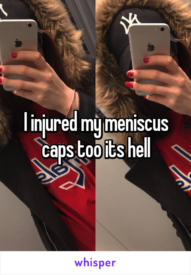 I injured my meniscus caps too its hell