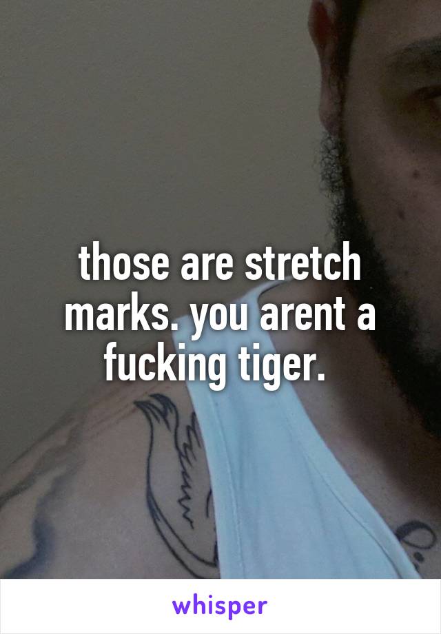 those are stretch marks. you arent a fucking tiger. 