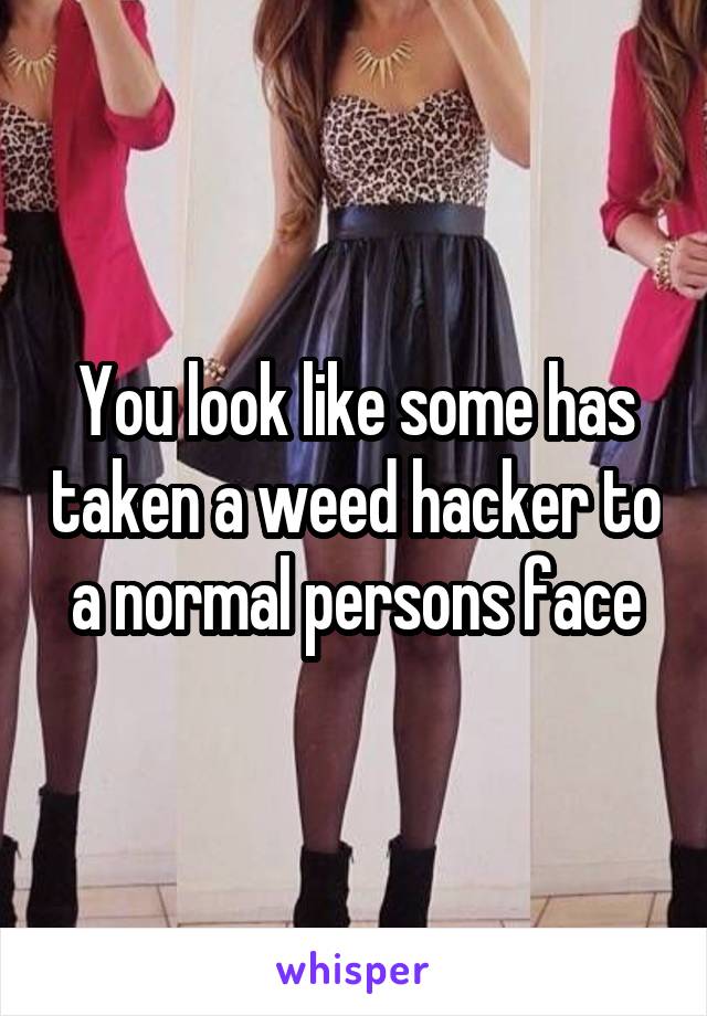 You look like some has taken a weed hacker to a normal persons face