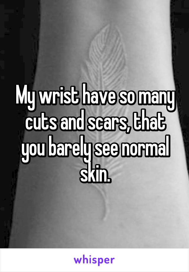 My wrist have so many cuts and scars, that you barely see normal skin.