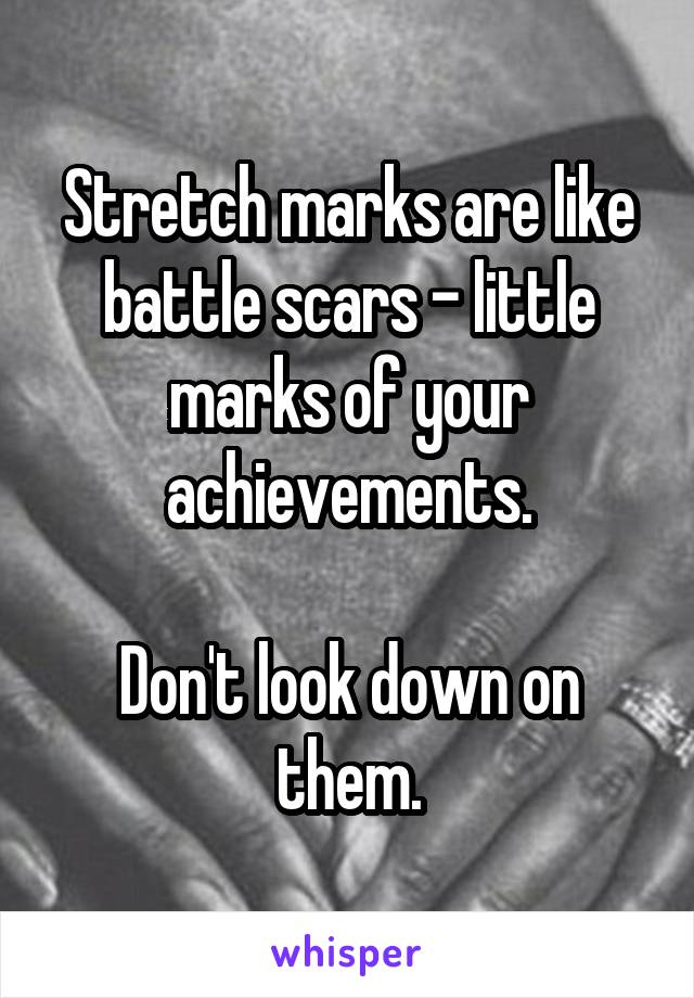 Stretch marks are like battle scars - little marks of your achievements.

Don't look down on them.